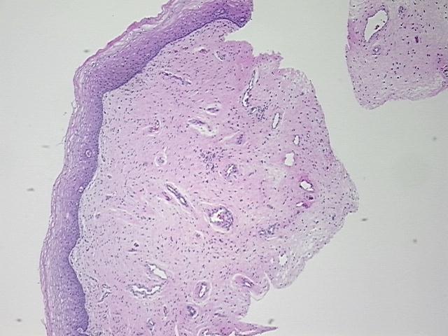 4x Image
