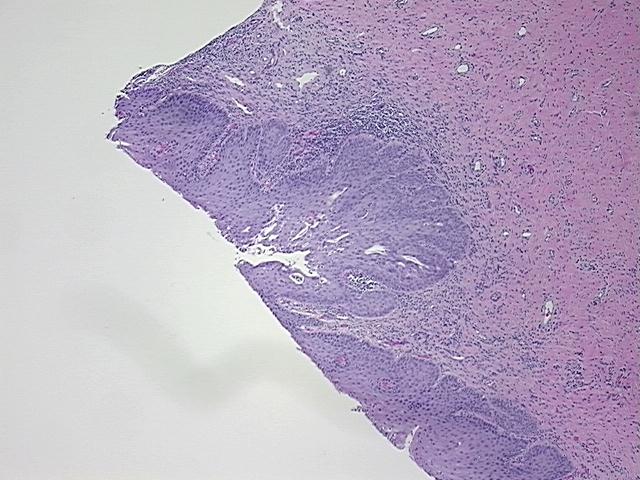 4x Image