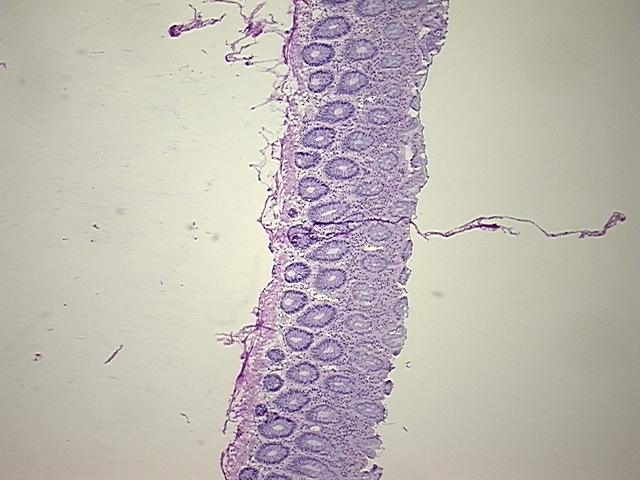4x Image