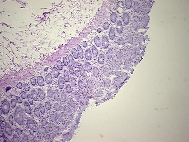 4x Image