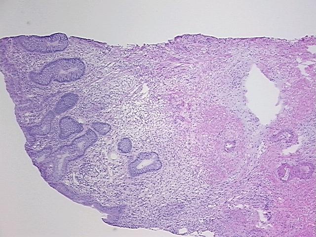 4x Image
