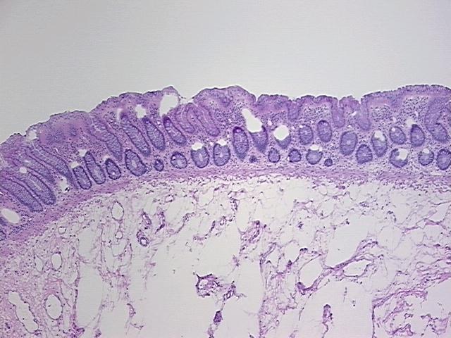 4x Image
