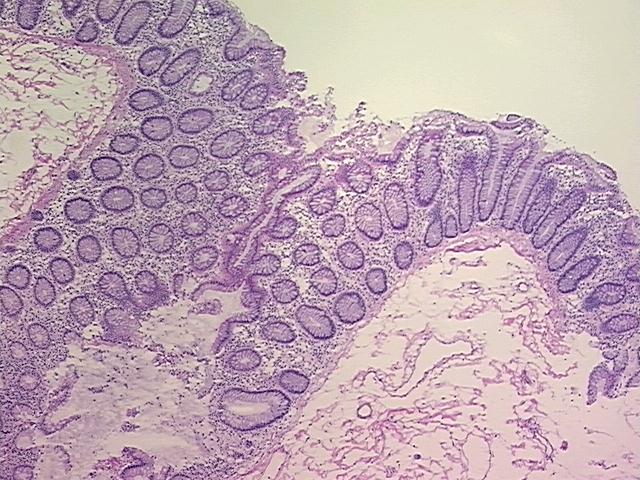 4x Image