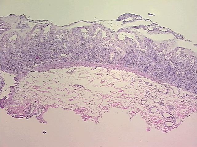 Frozen Tissue Sections, Colon