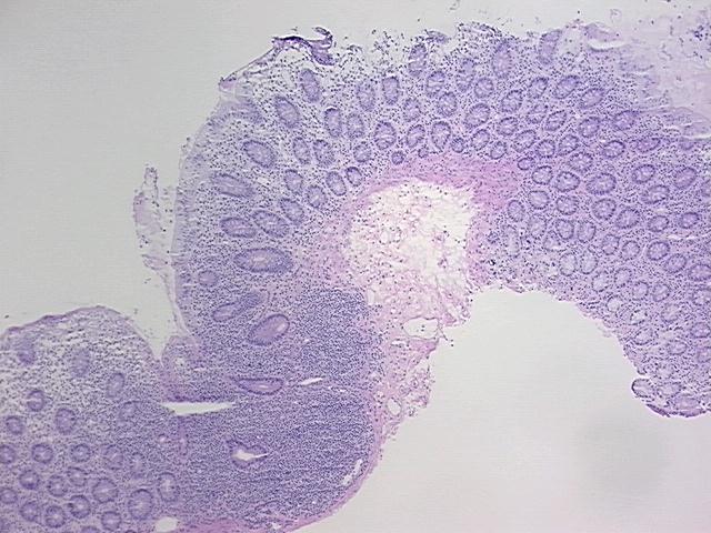 4x Image