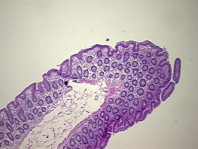 4x Image