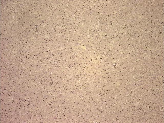 4x Image