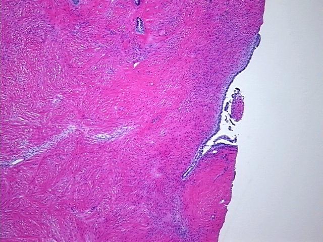 4x Image