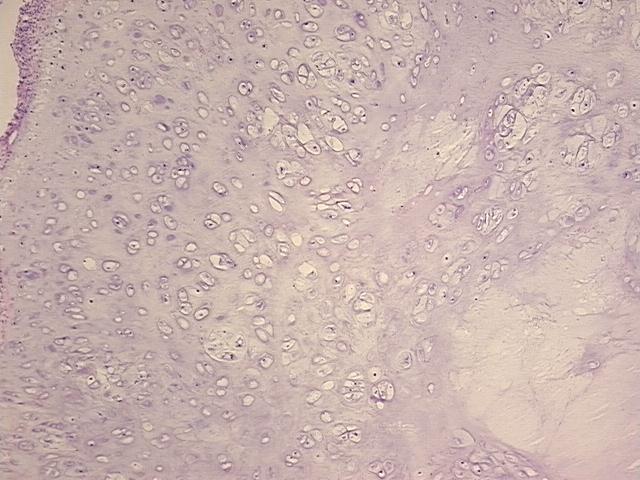 4x Image