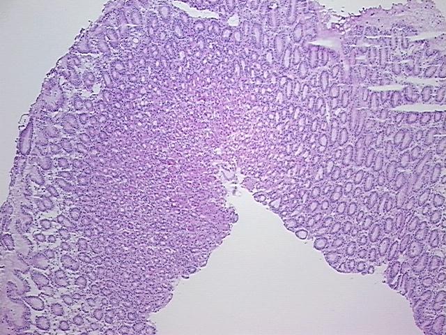 4x Image