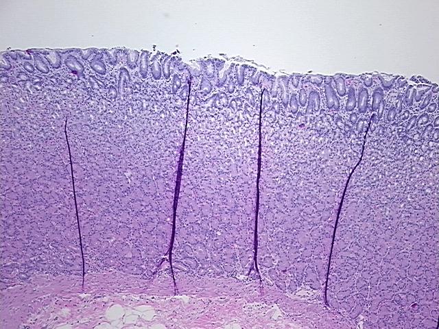 4x Image