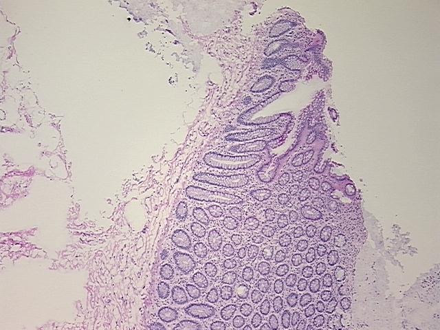 4x Image