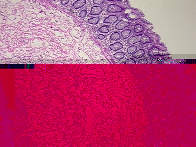 4x Image
