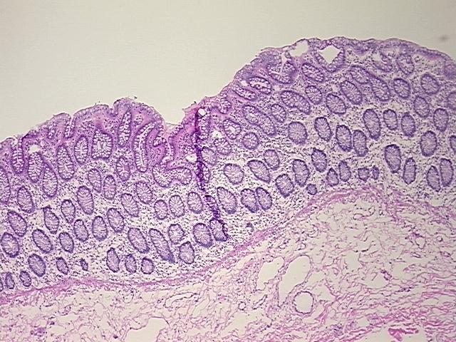 4x Image