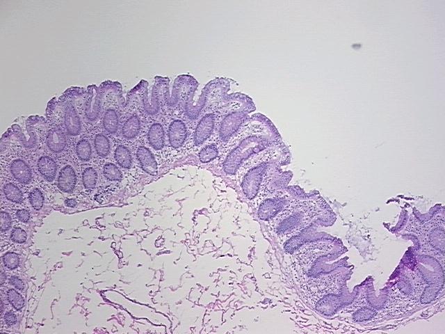 4x Image