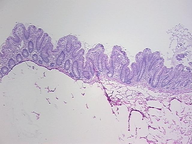 4x Image