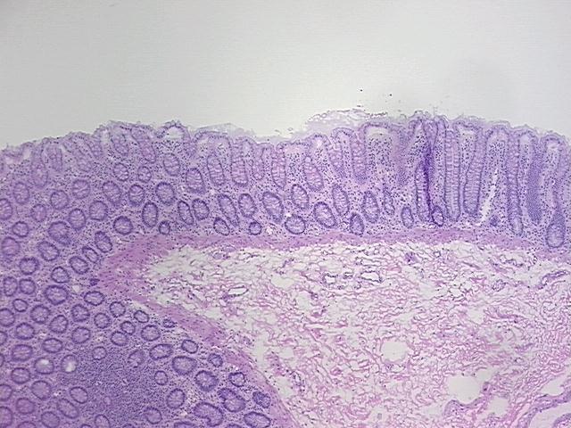4x Image