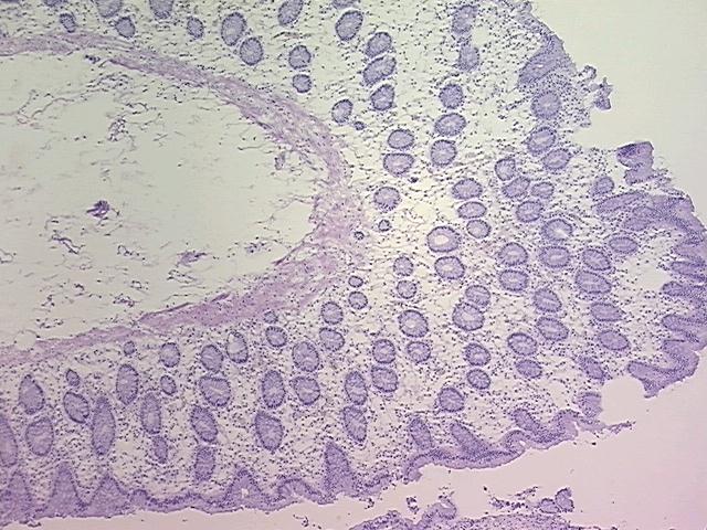 4x Image
