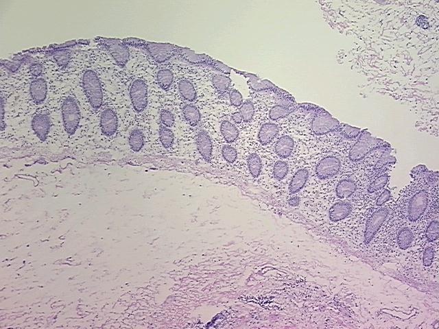 4x Image