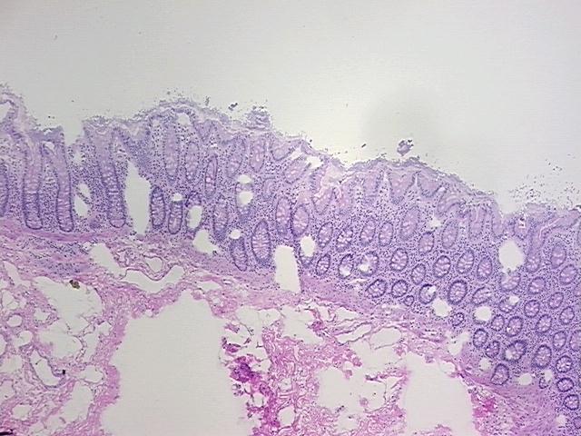4x Image