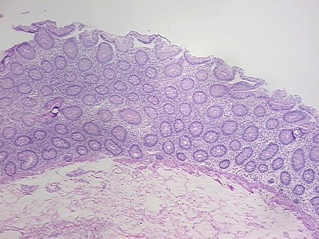 4x Image