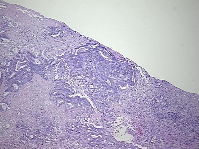 4x Image