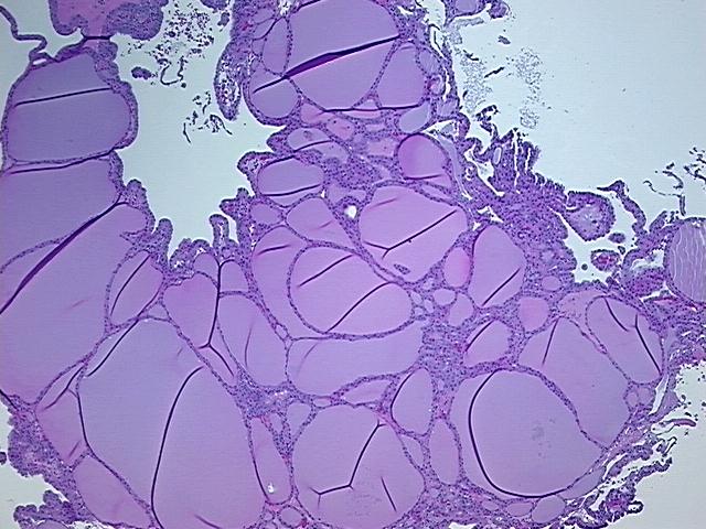 4x Image