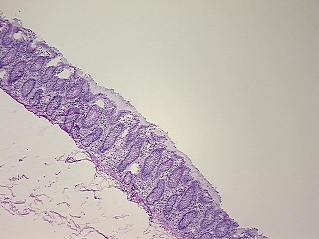 4x Image