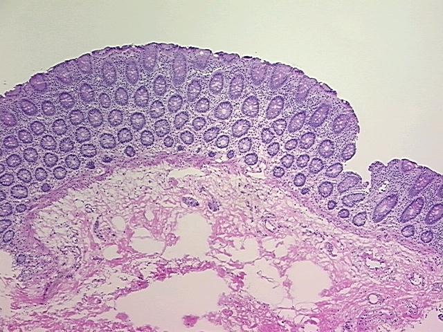 4x Image