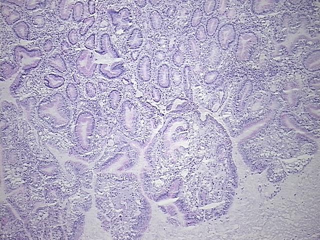 4x Image