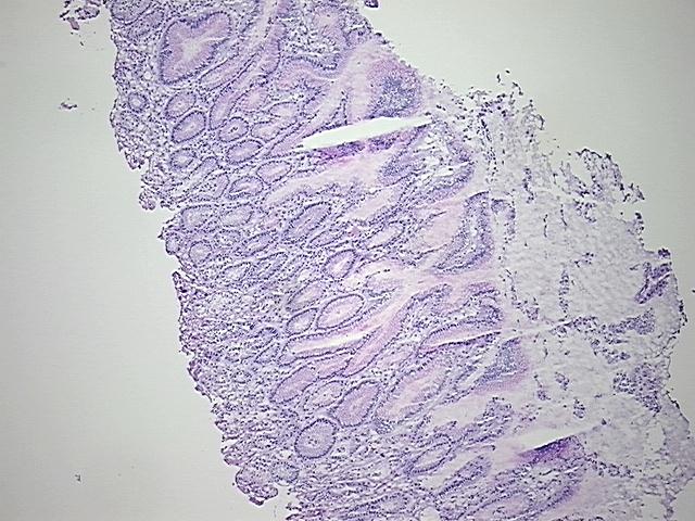 4x Image