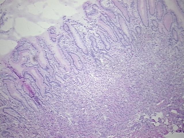 4x Image