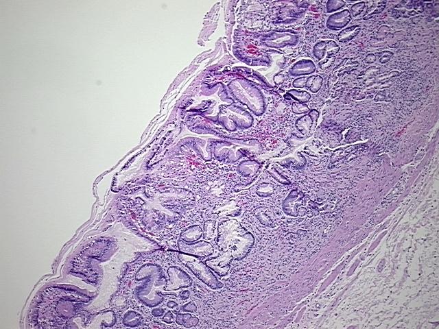 4x Image