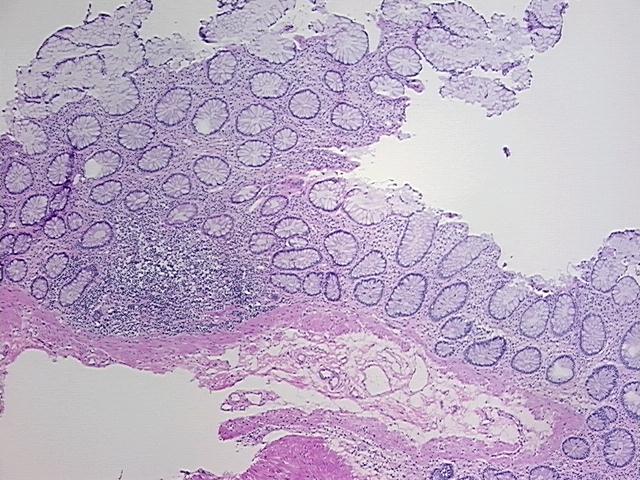 4x Image