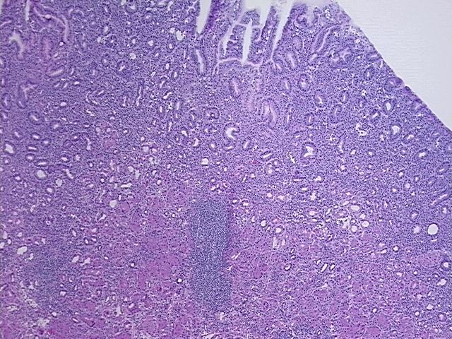 4x Image