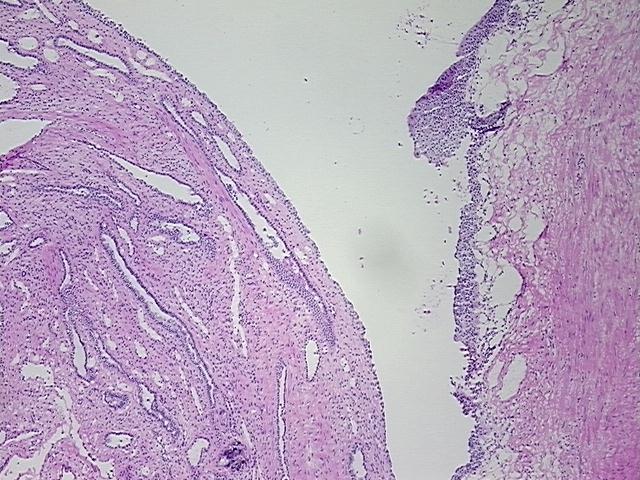 4x Image