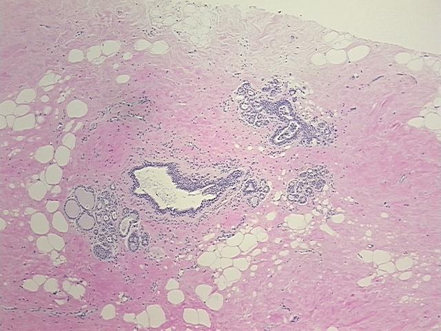 4x Image