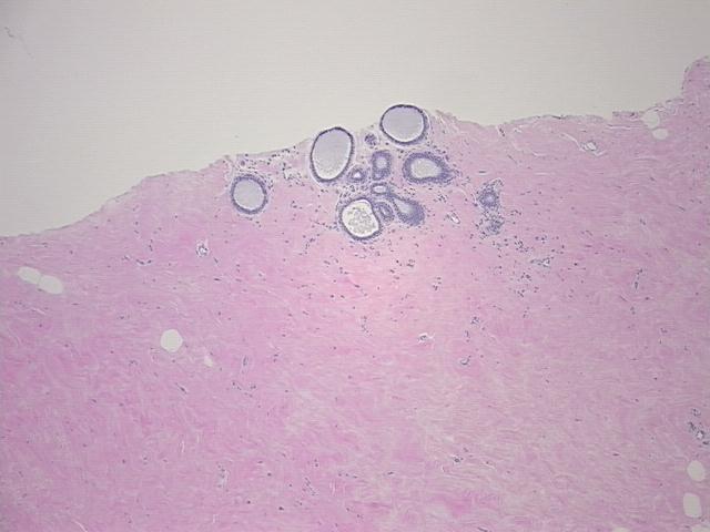 4x Image