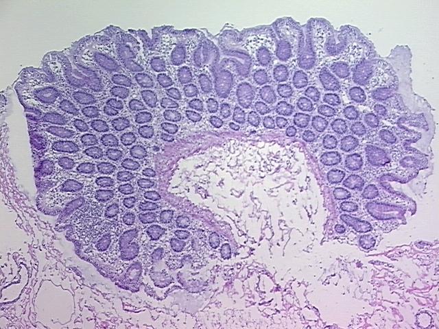 4x Image
