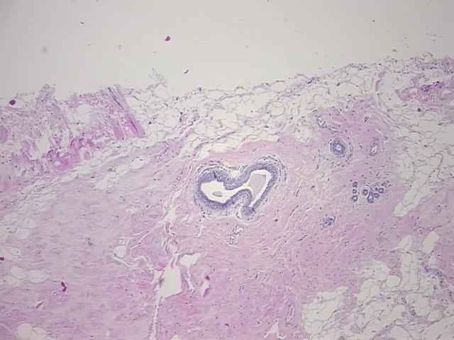 4x Image