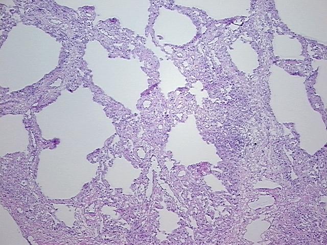 4x Image