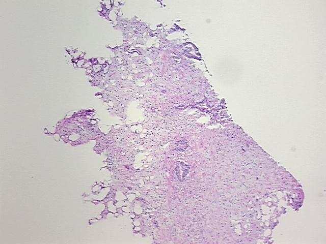 4x Image