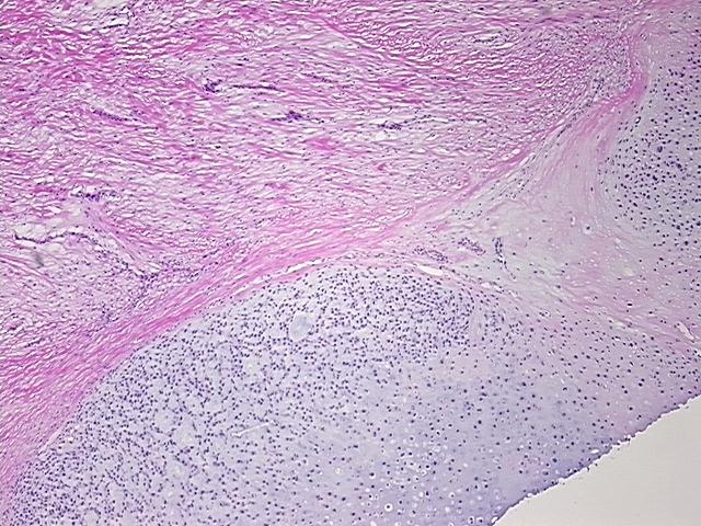 4x Image