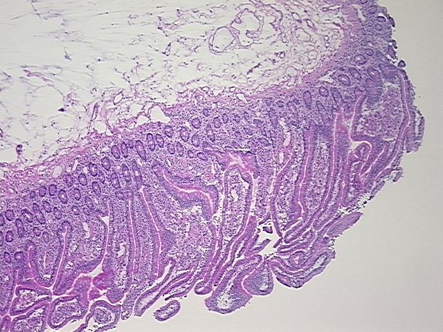 4x Image