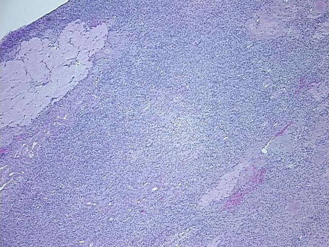 4x Image