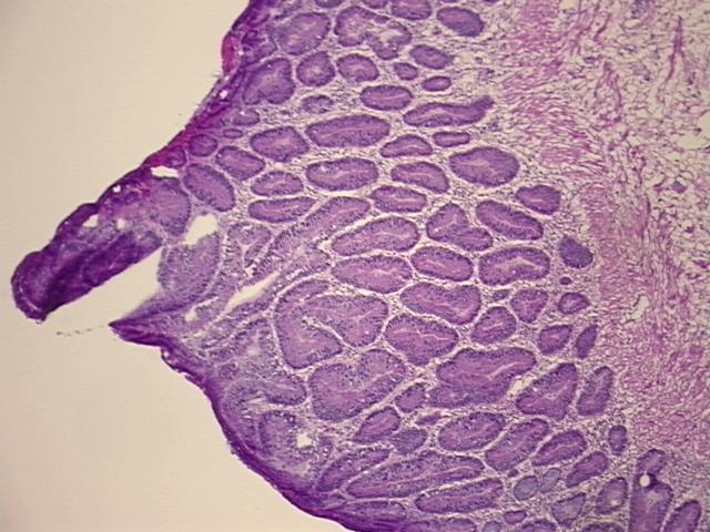 4x Image