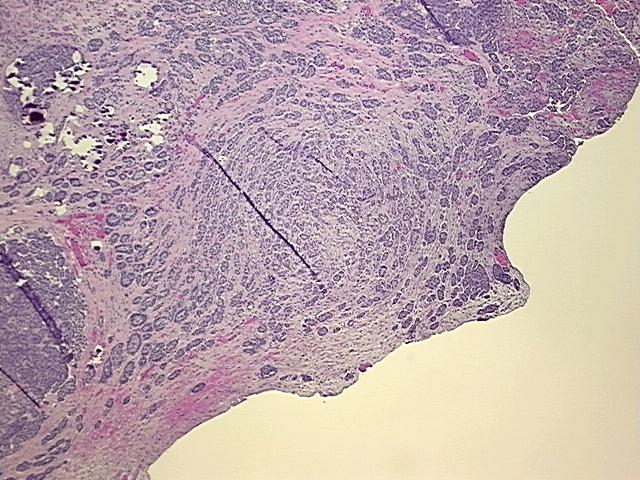 4x Image