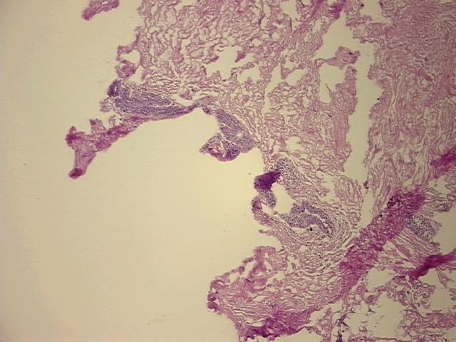 4x Image