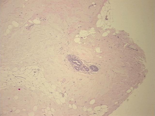 4x Image