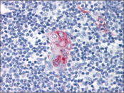 Human thymus stained with anti-CD1D mouse monoclonal antibody (AM20466PU-N)